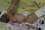 В Свердловской области начали проводить лапароскопические операции двенадцатиперстной кишки новорожденным