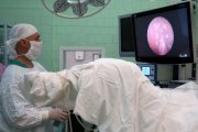 Свердловские онкопроктологи успешно провели первую операцию по удалению опухоли без разрезов и проколов брюшной полости