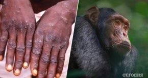 Оспа обезьян в России: что важно знать о заболевании